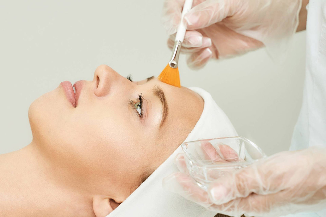 Facial Chemical Peeling